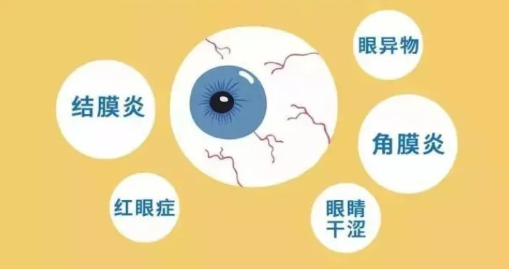 快醒醒！隐形眼镜属于“ 高风险 ”医疗器械！这些危害一定要知道！(图4)